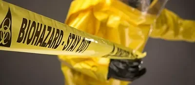 SCU Services i-3-400x175 Blog